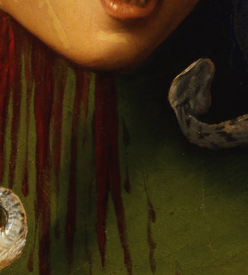 Blood at the neck